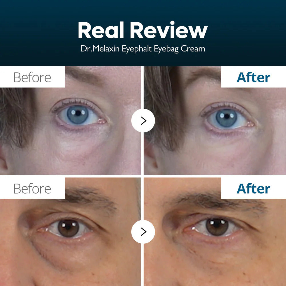 Velora Eye Bag Removal Cream™