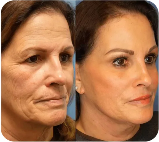 Velora Instant Face Tightener® No-Filter Primer